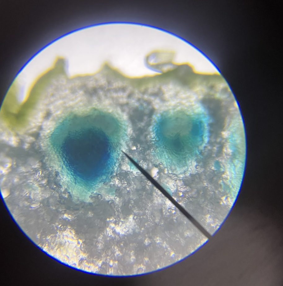 A microscope view of a stained biology specimen